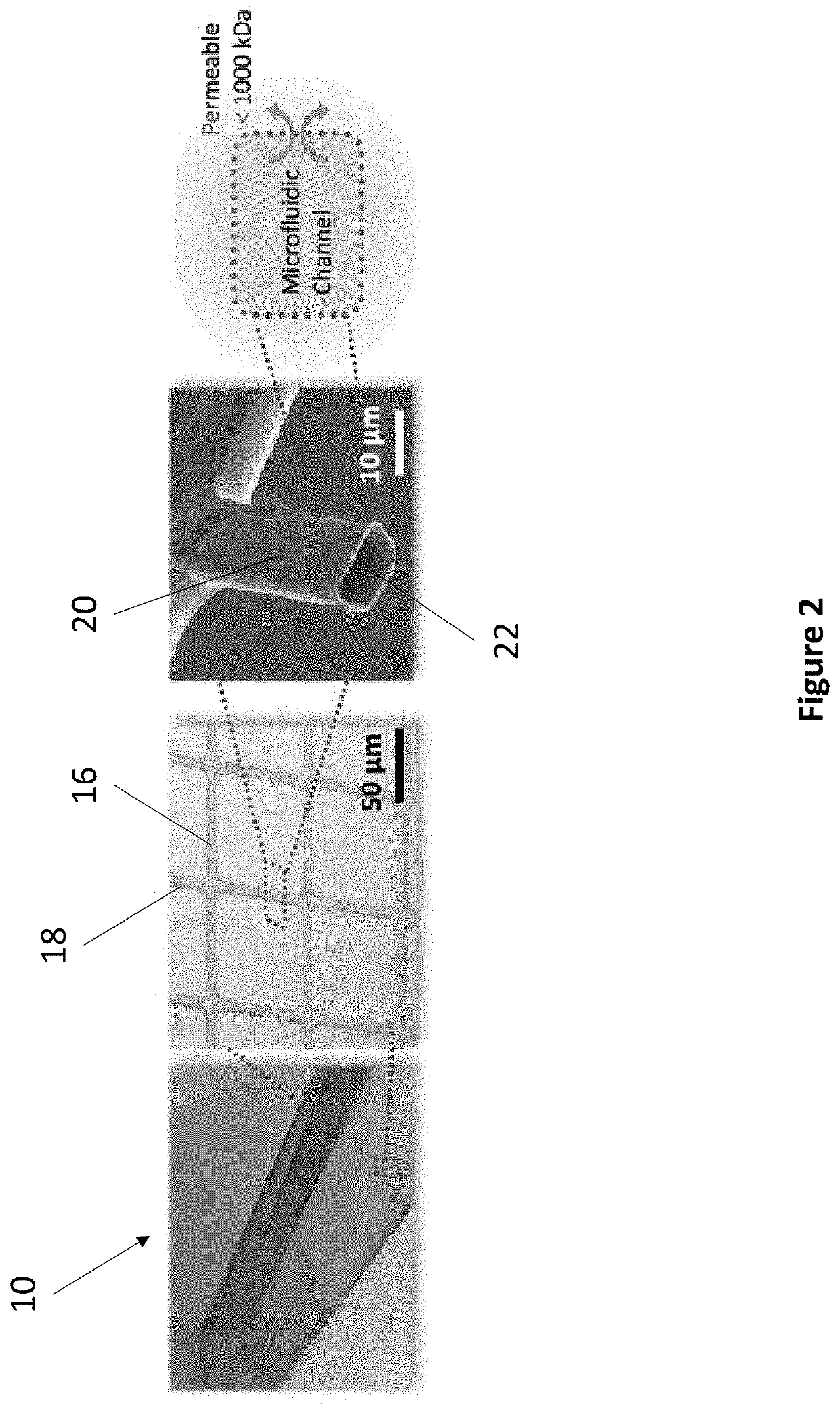 A novel flexible microfluidic meshwork for glaucoma surgery