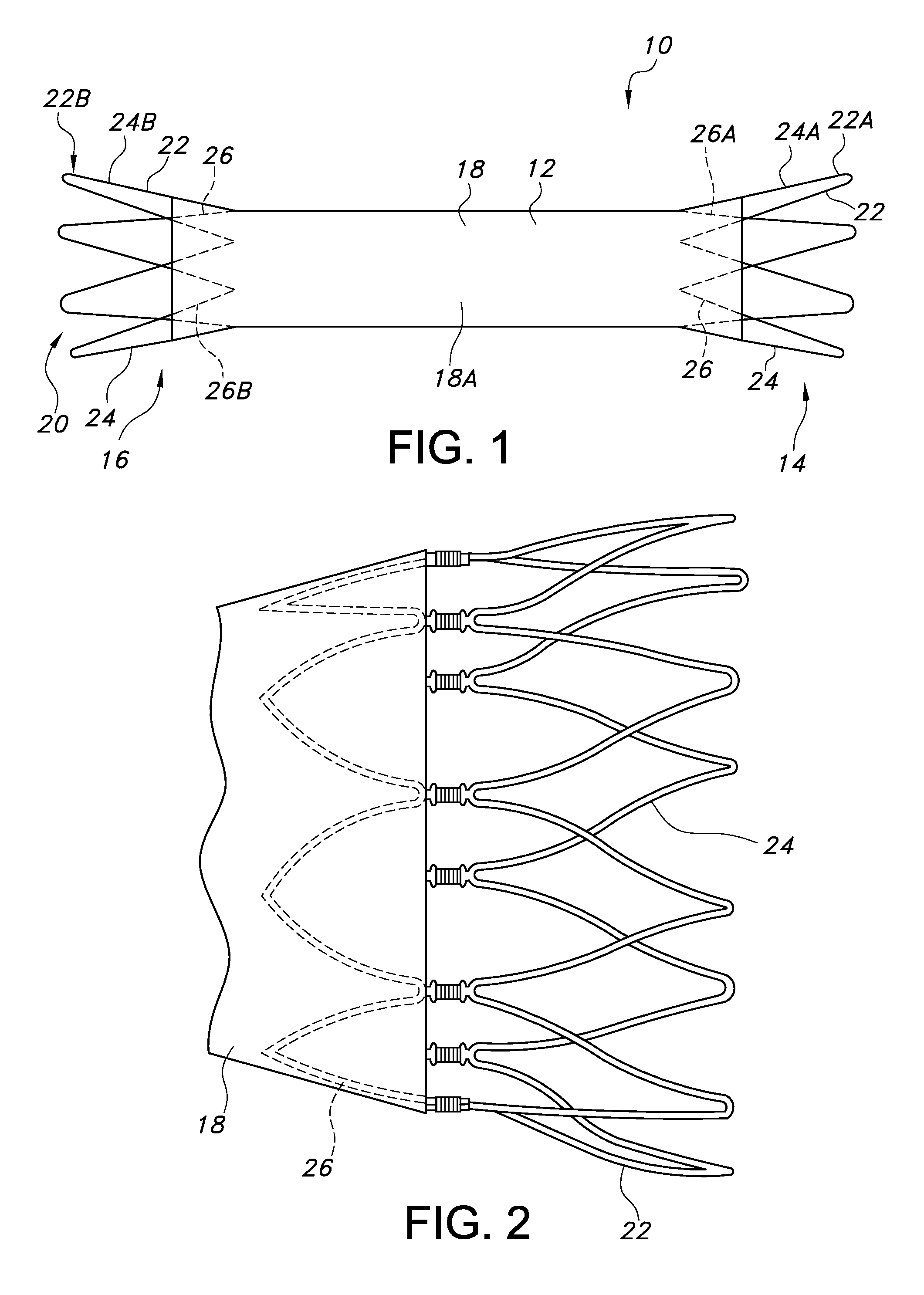 Sac liner for aneurysm repair