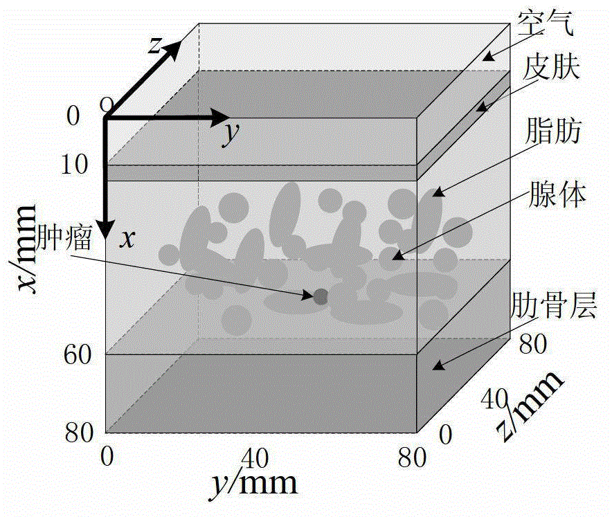 Breast tumor characteristic signal extraction method for ultra wide band microwave detection