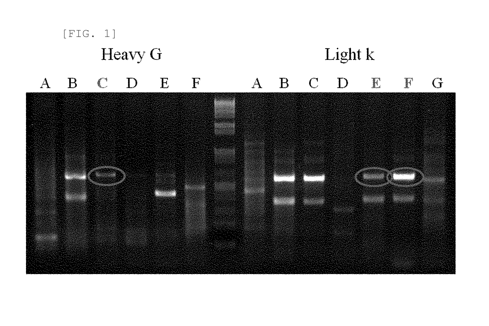 Composition for Cancer Prognosis Prediction Comprising Anti-TMAP/CKAP2 Antibodies