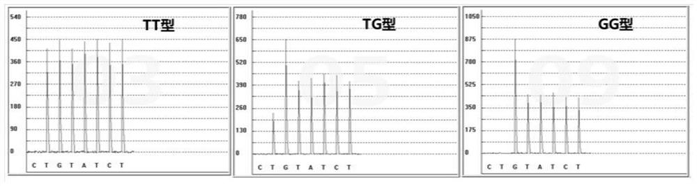 Gene detection kit for administration of angiotensin II receptor inhibitors as well as detection method and application of gene detection kit