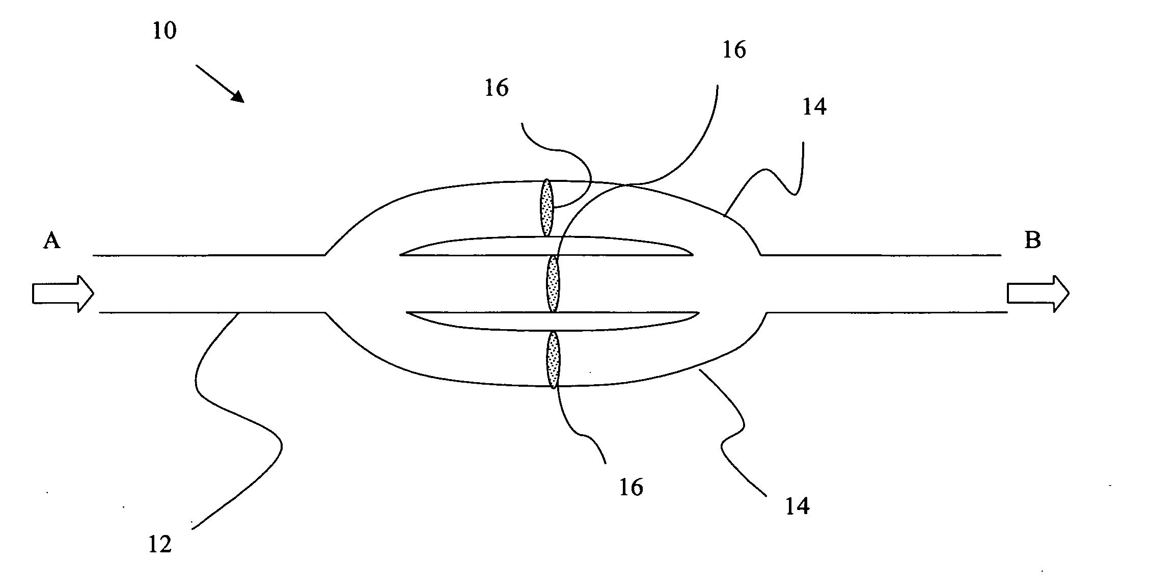 Implantable prosthetic device for connection to a fluid flow pathway of a patient