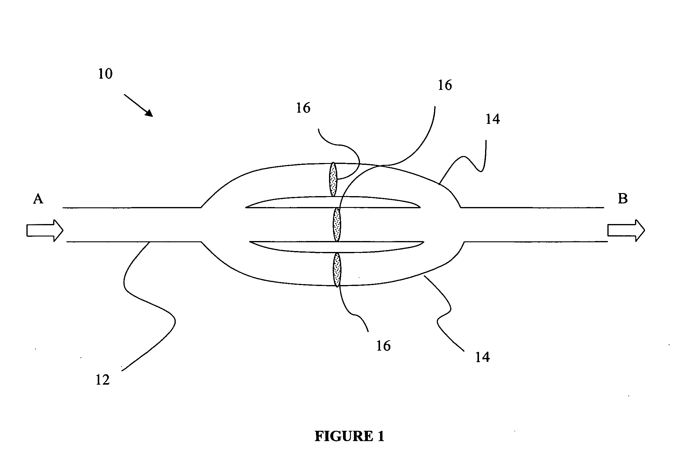 Implantable prosthetic device for connection to a fluid flow pathway of a patient