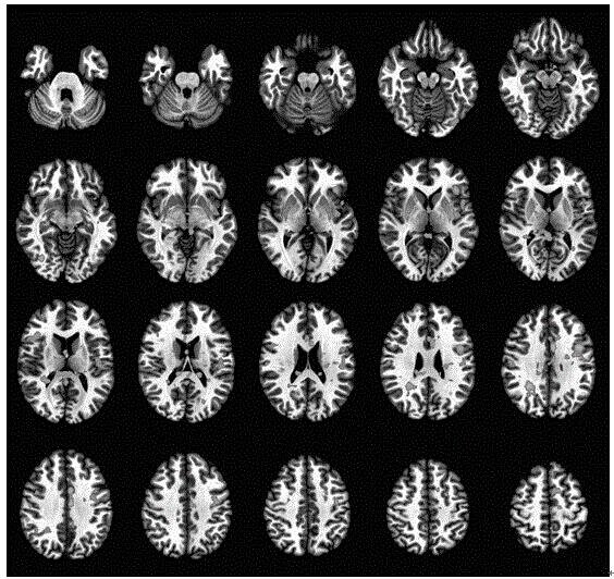 A method for fMRI identification of camouflaged cognitive dysfunction