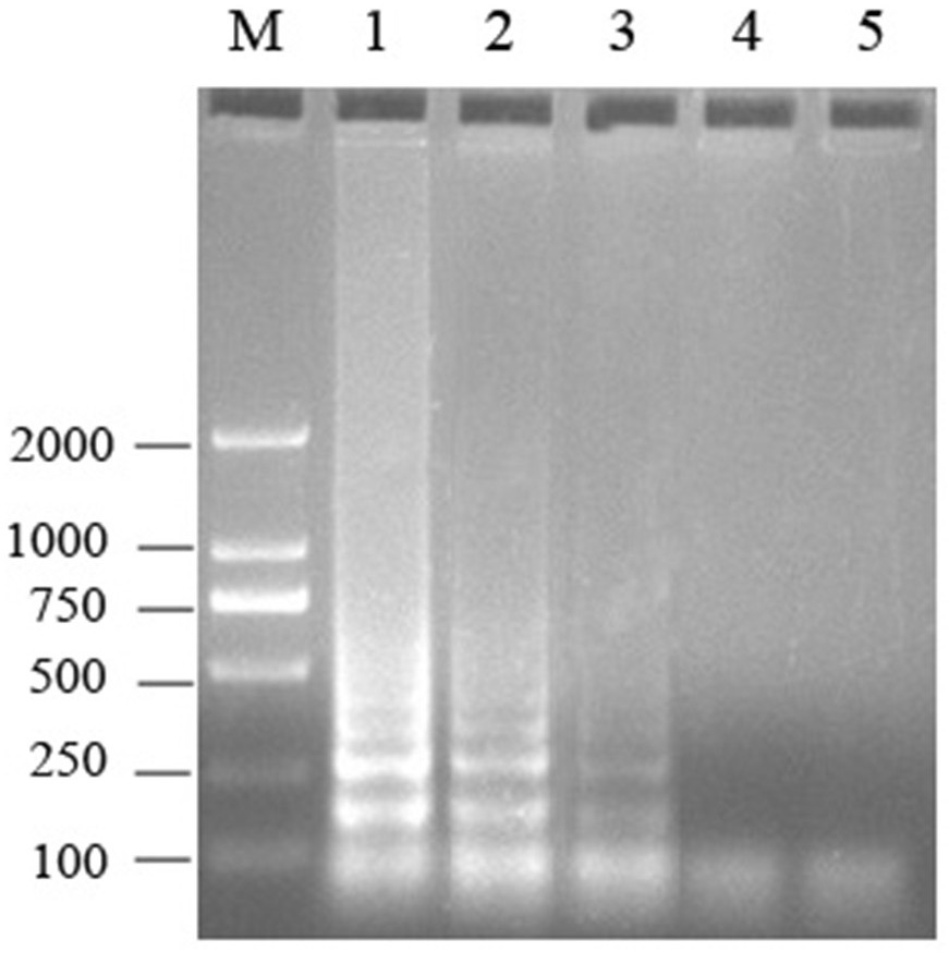 A set of primers for detection of influenza C virus lamp and its application