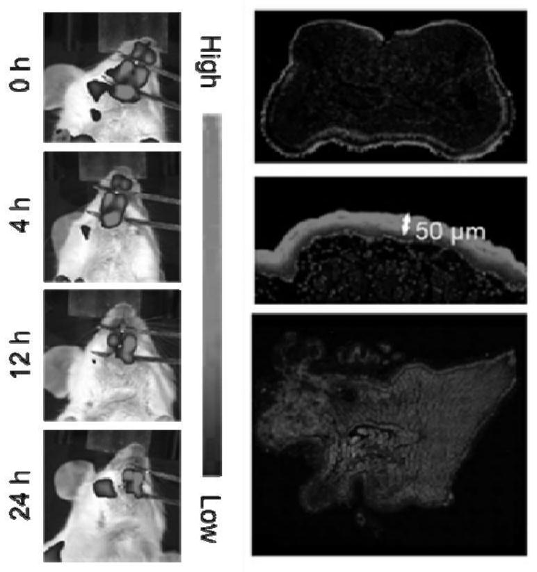 Silver nano hydrogel for regulating flora to activate immune response and preparation method and application thereof