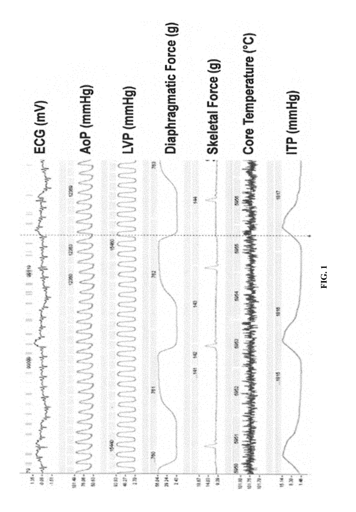 Compositions and methods for reducing muscle contraction