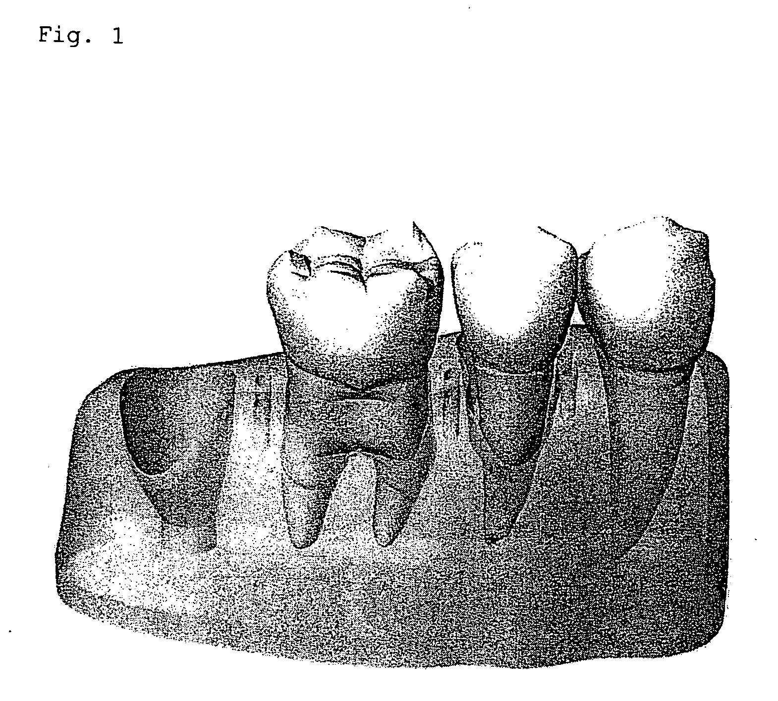 Biocompatible Membrane and Process for Producing the Same
