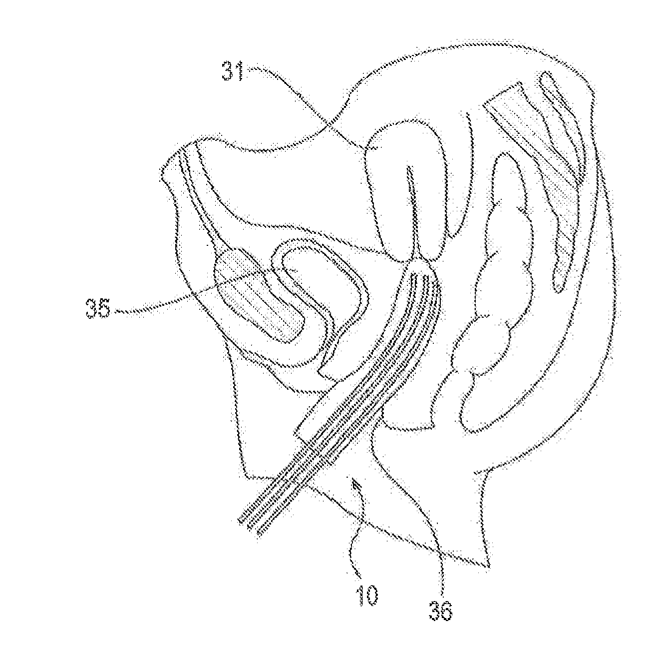Medical applicator and methods of making