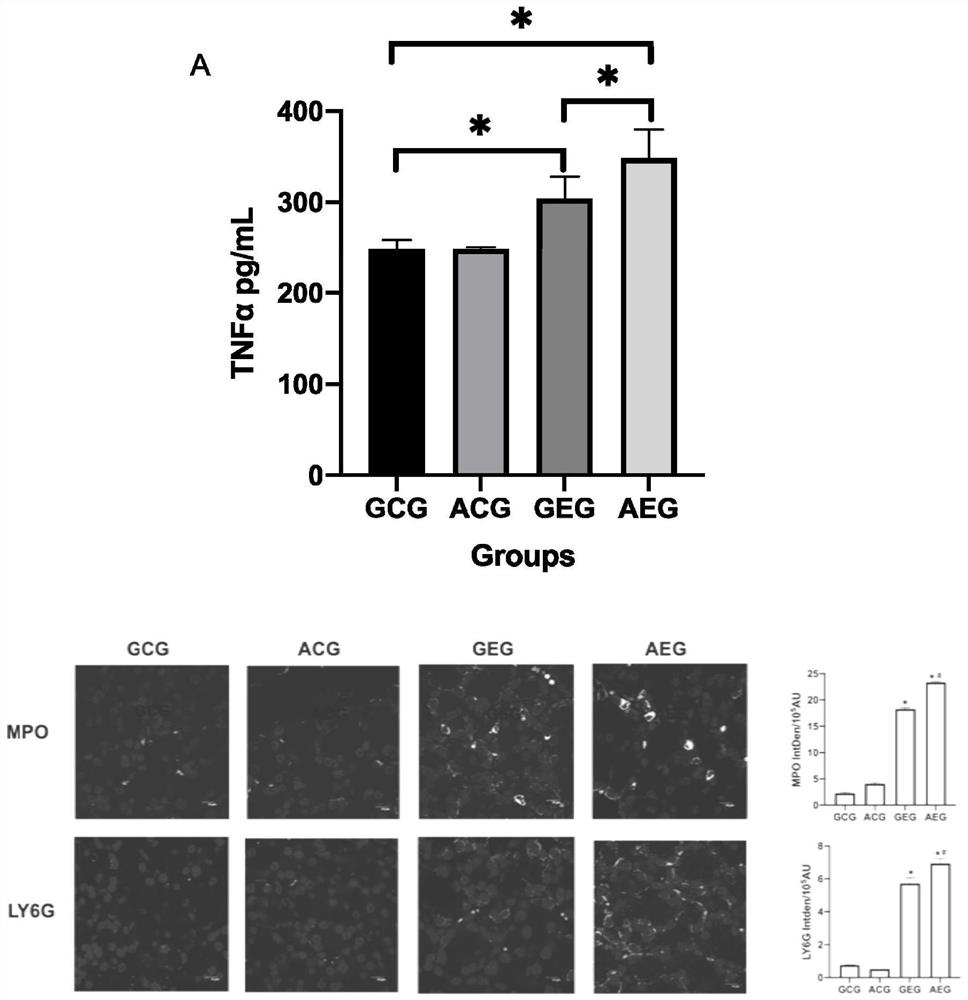 Application of CPT1A protein in alcoholic acute pancreatitis disease