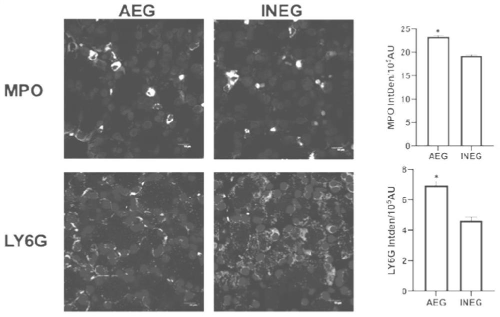 Application of CPT1A protein in alcoholic acute pancreatitis disease