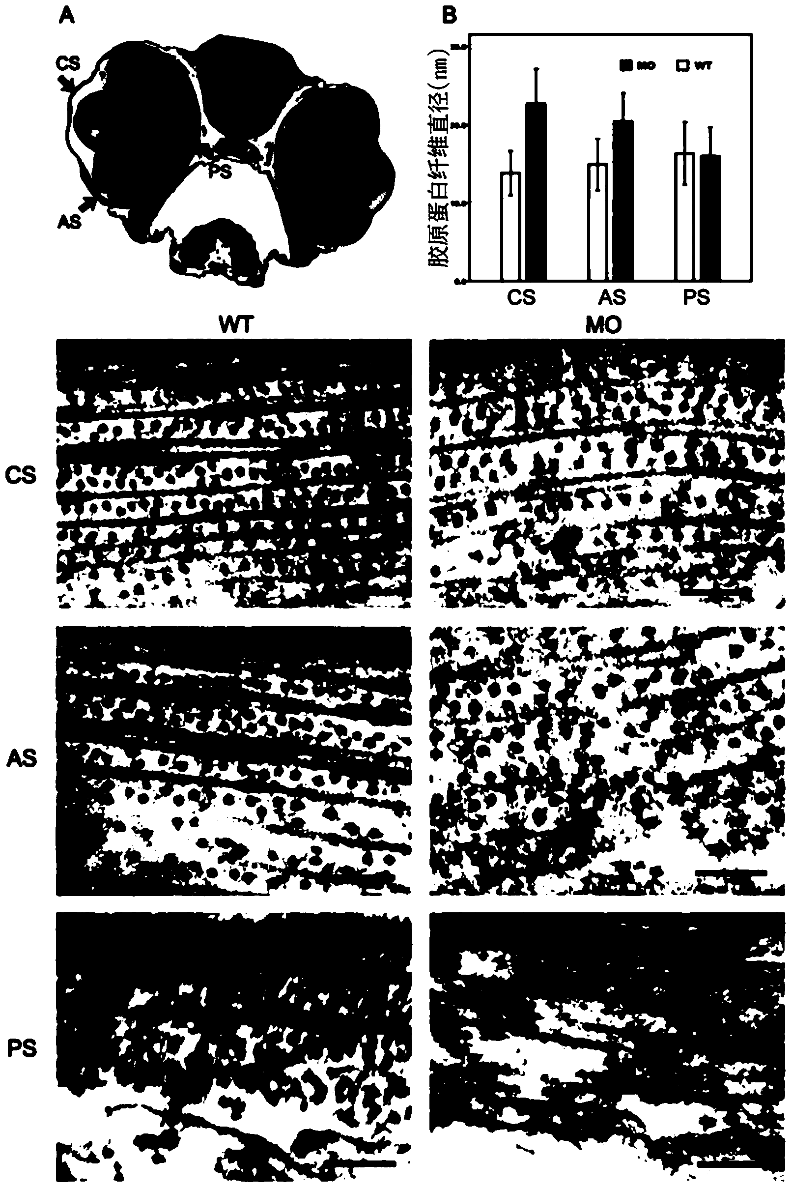 Methods for drug screen using zebrafish model and the compounds screened thereform