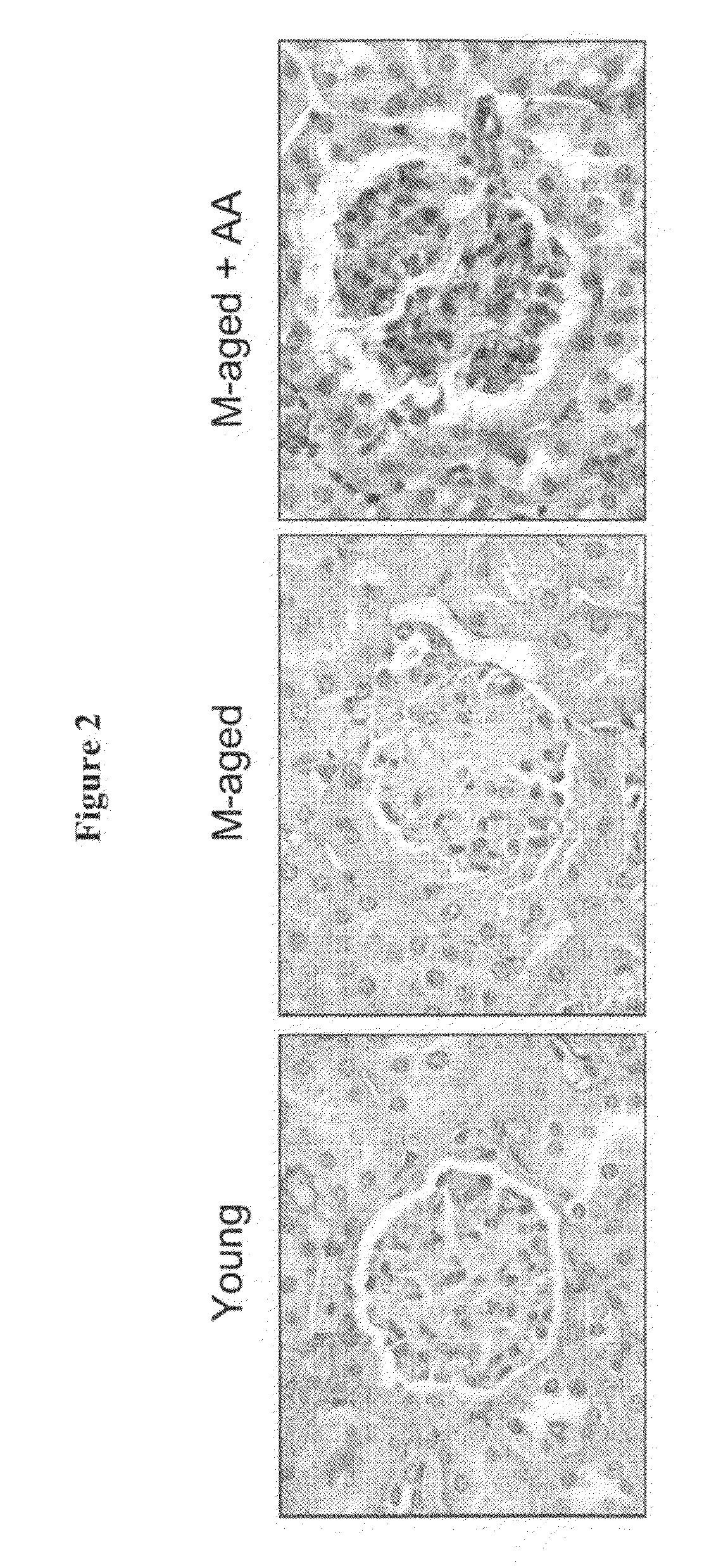 Compositions comprising amino acids for prevention and/or treatment of renal disorders