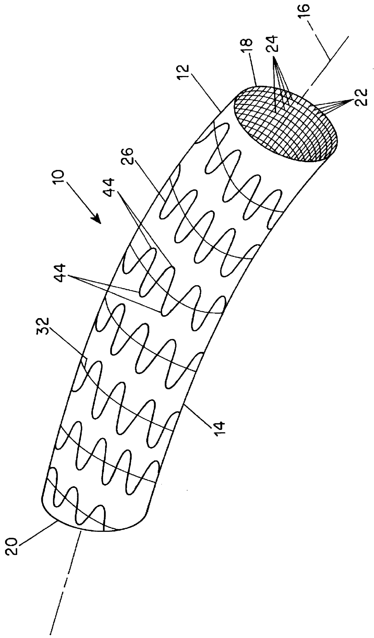 Woven stent/graft structure