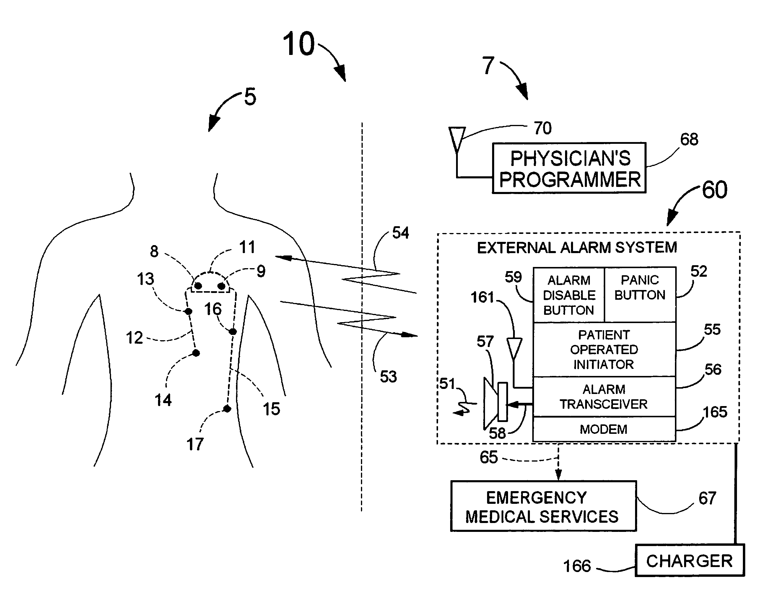 Means and method for the detection of cardiac events