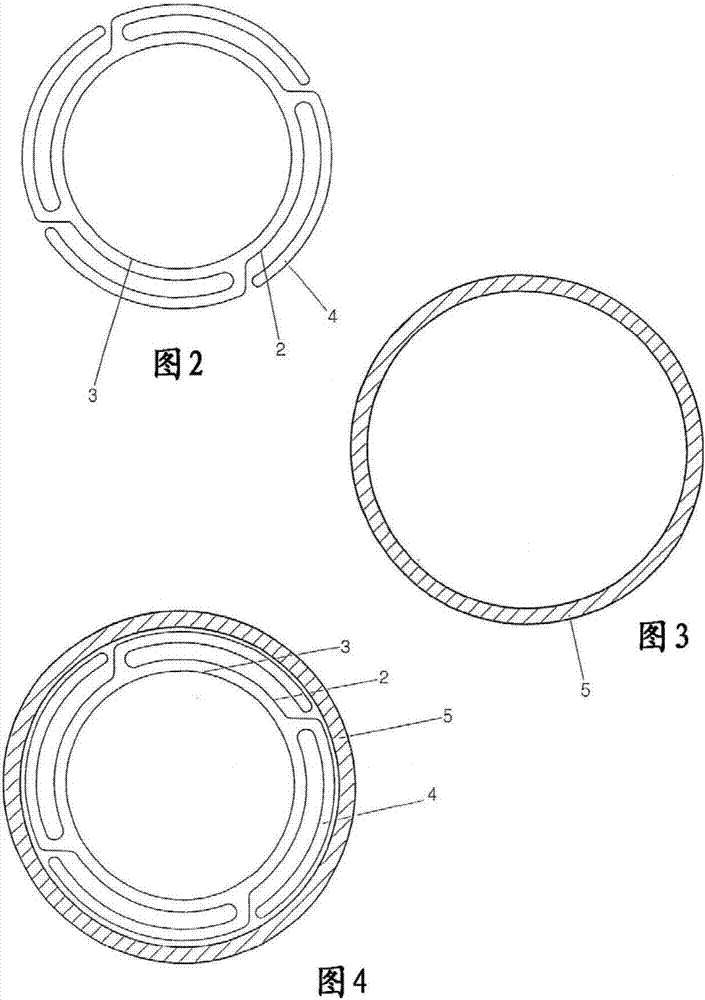 Cutback method for intravascular dilation catheter