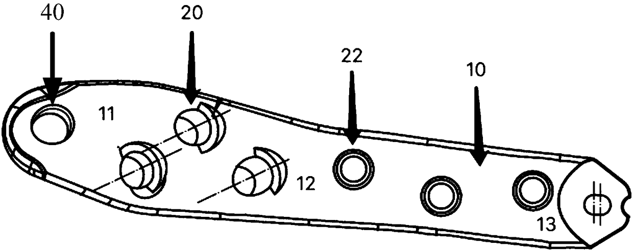 Locking steel plate for femoral neck fracture reduction