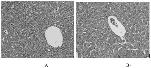 Construction method and application of age-dependent hepatitis B mouse model system of a kind of balb/c background