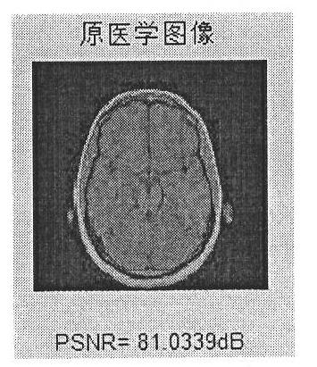 DCT (discrete cosine transform)-based anti-geometric-attack zero-digital-watermarking method for medical image