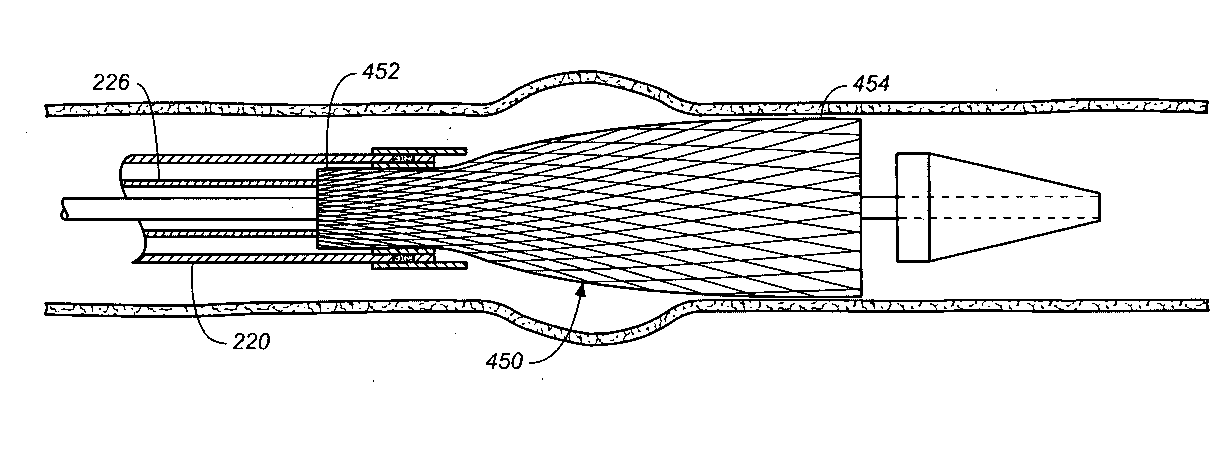 Endovascular Delivery System Having Textile Component for Implant Restraint and Delivery