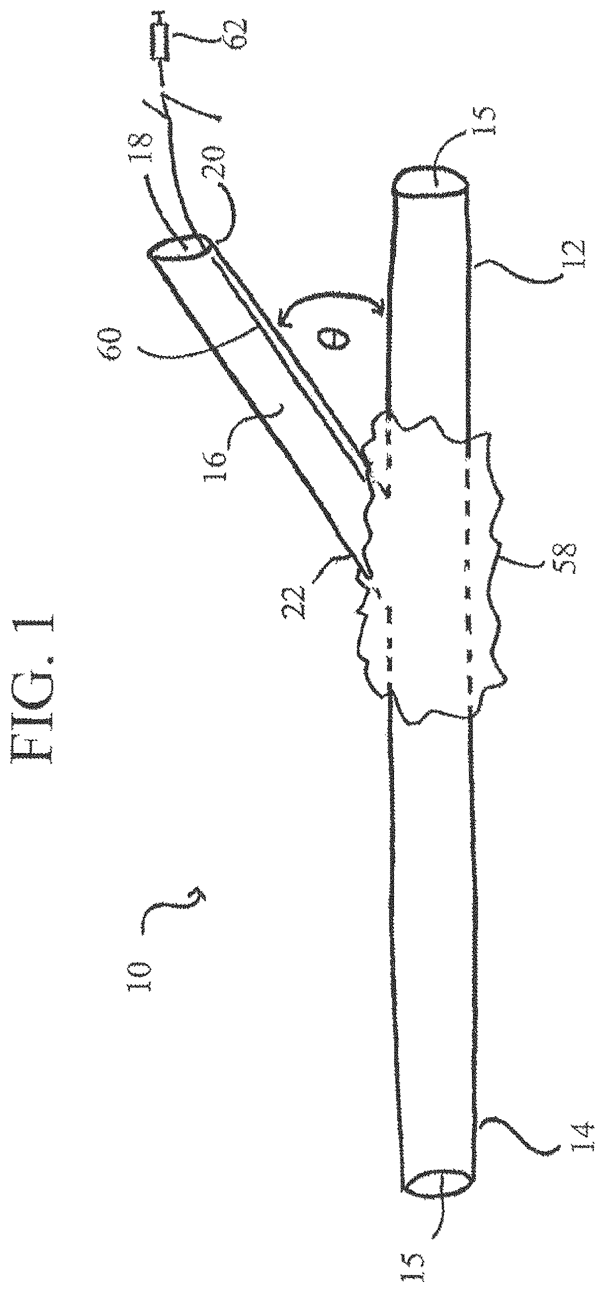 Systems, devices, and methods for organ retroperfusion along with regional mild hypothermia