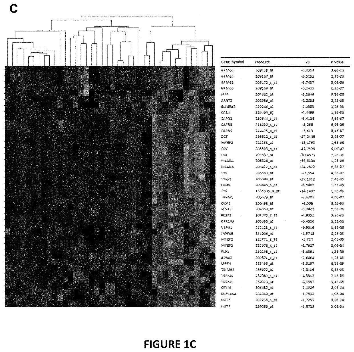 Proteins of the WNT signaling pathway and uses thereof in the diagnostic and treatment of hypopigmentation disorders