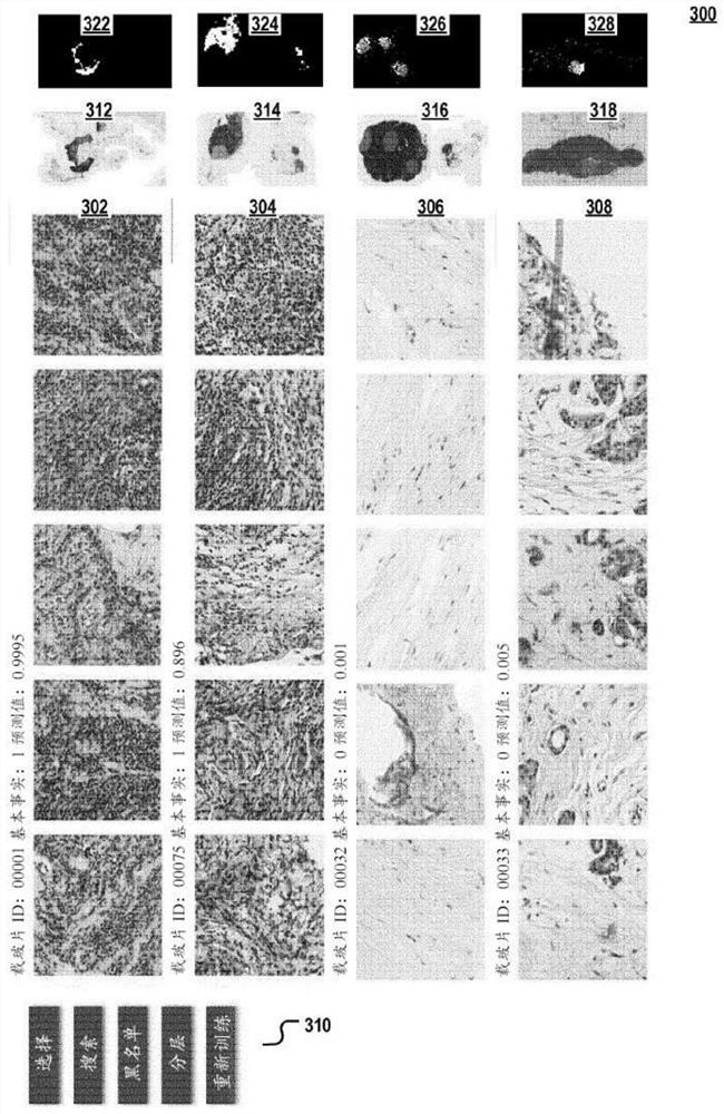 Multiple instance learner for prognostic tissue pattern identification