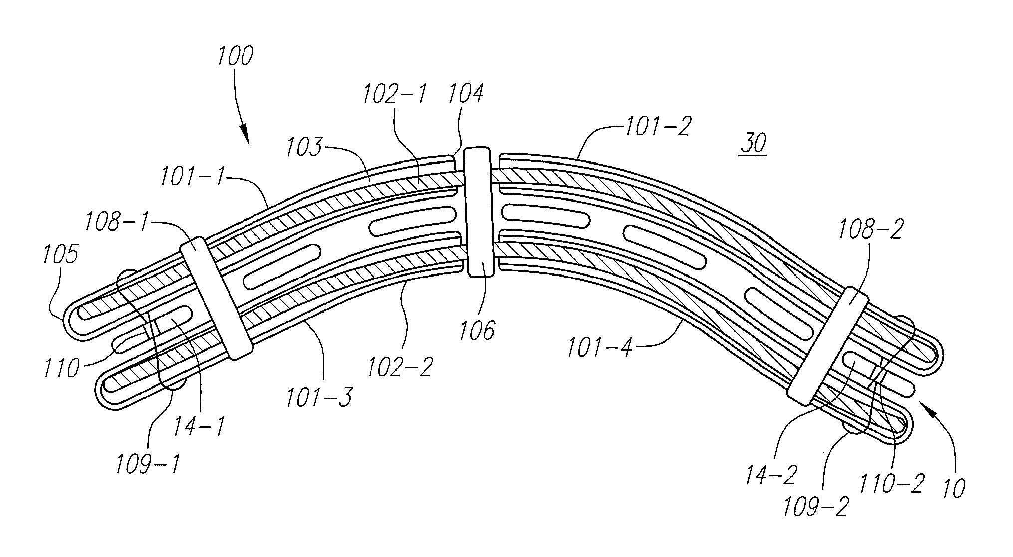 Systems, Devices and Methods for the Correction of Spinal Deformities