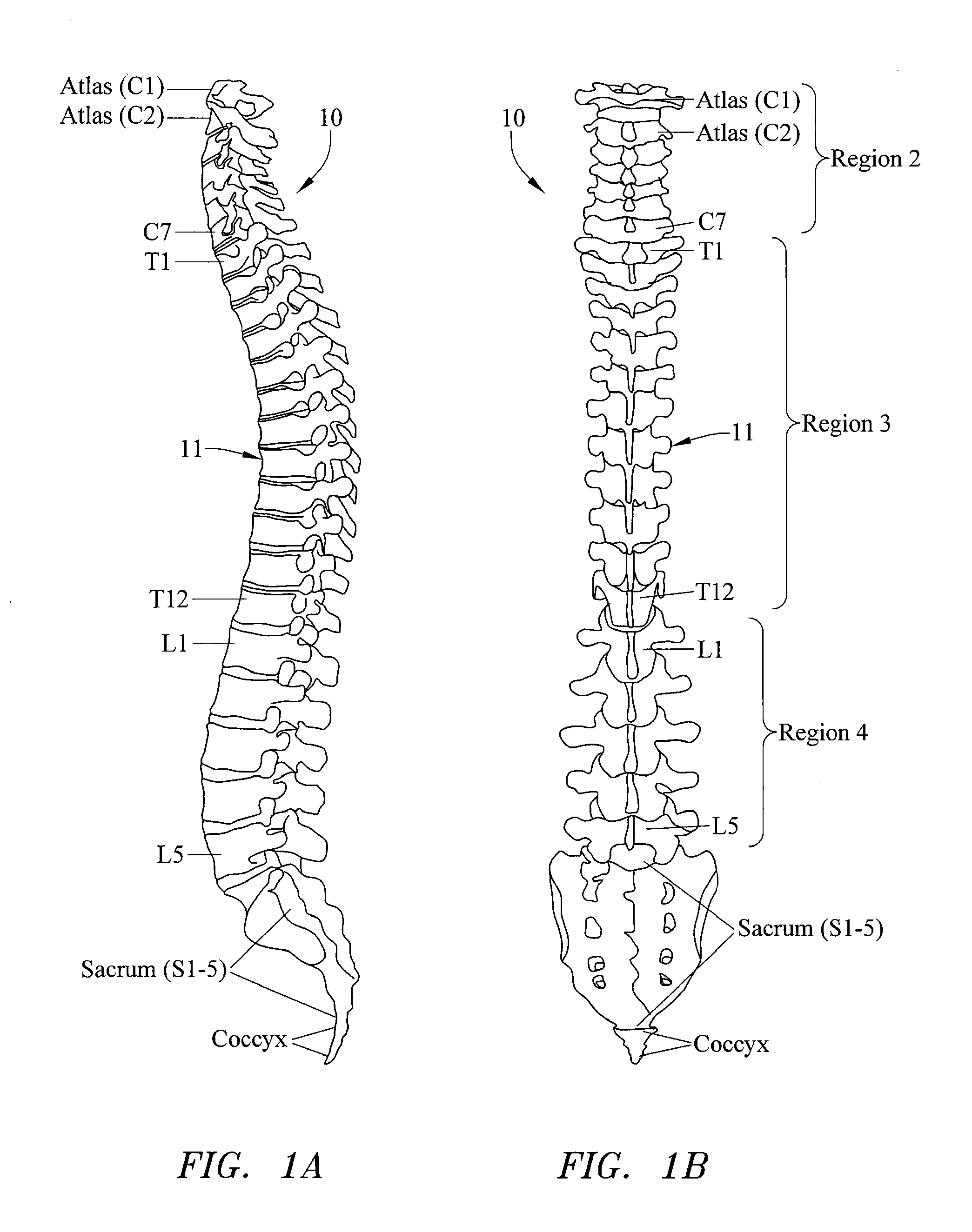 Systems, Devices and Methods for the Correction of Spinal Deformities