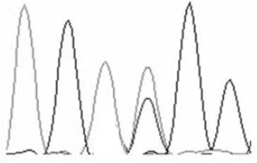 A gene molecular marker, detection method and kit related to yak physique