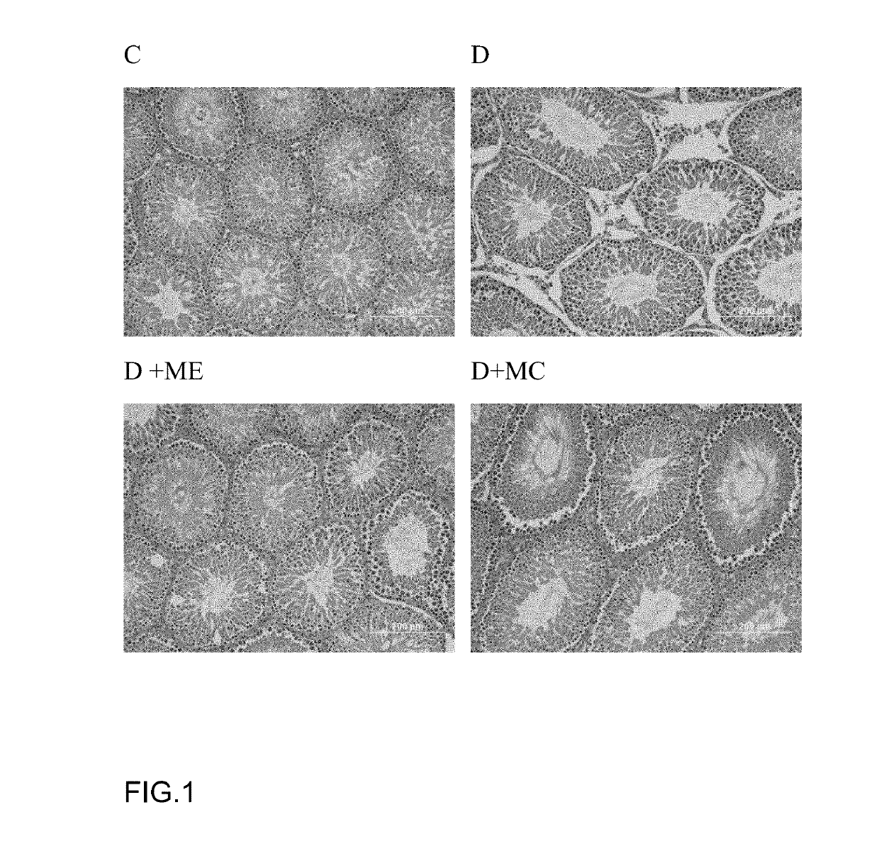 Active substance of morchella, its use and a composition thereof for improving the reproductive function