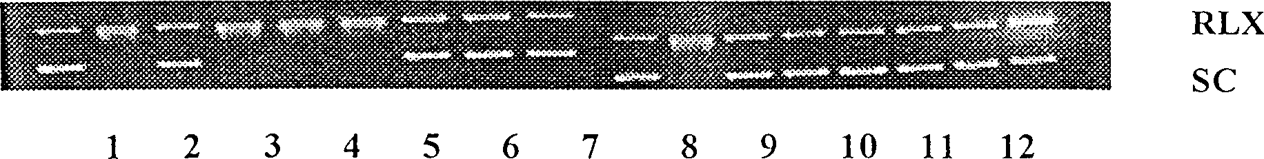 Medicinal composition containing algal protein polyose extract and extraction of algal protein polyose