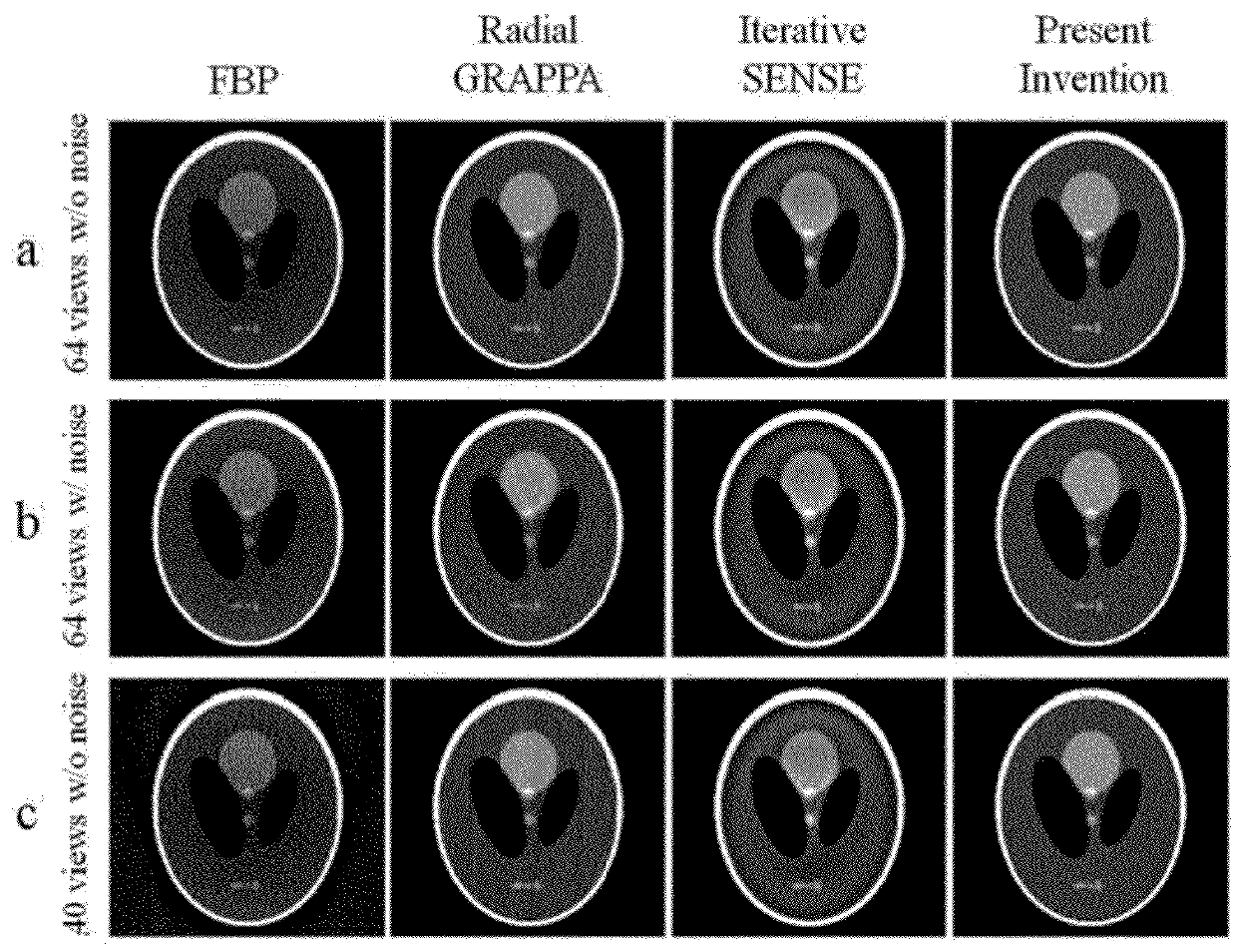 Parallel magnetic resonance imaging method for radial trajectory