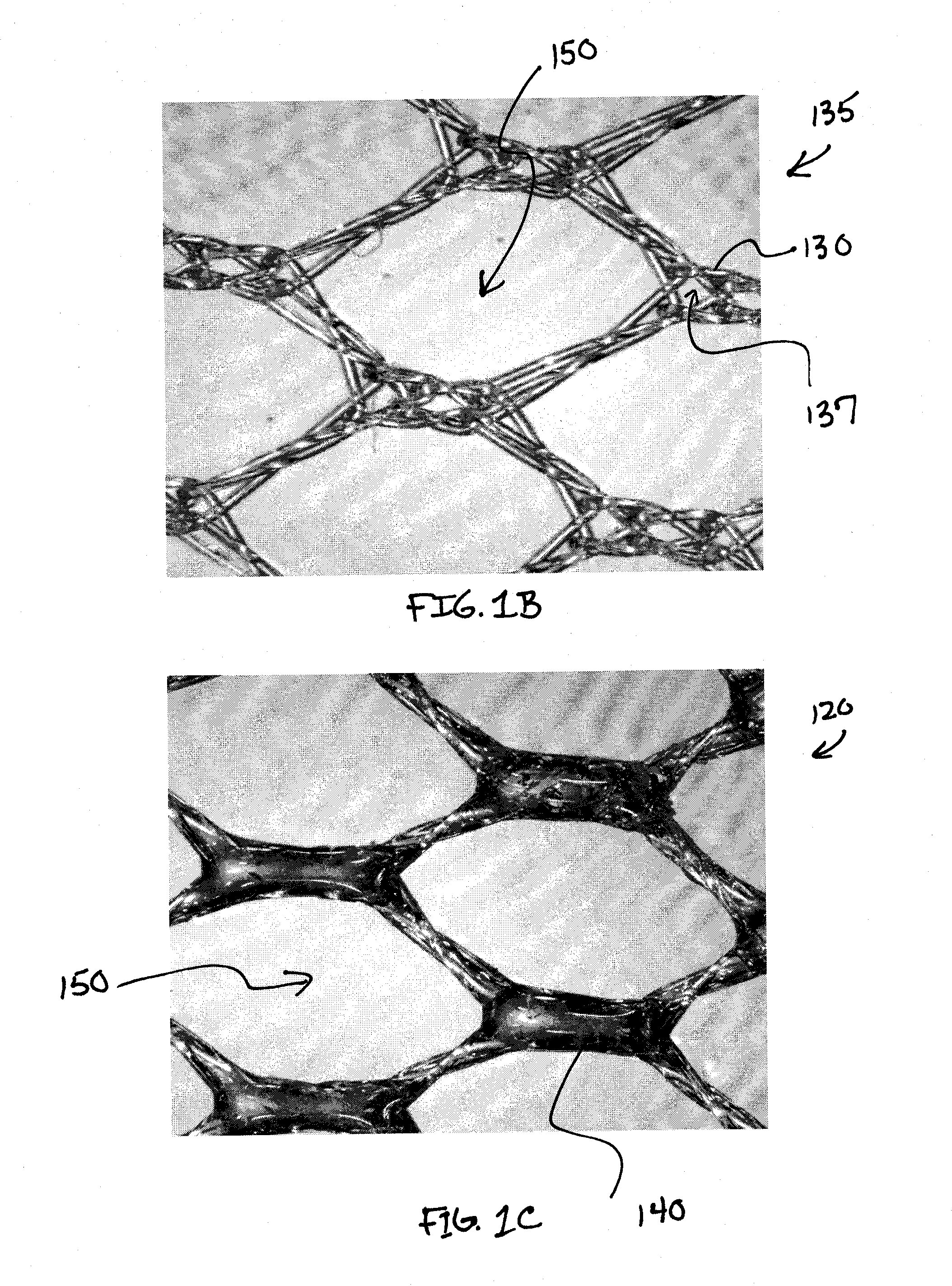 Apparatus and method for limiting surgical adhesions