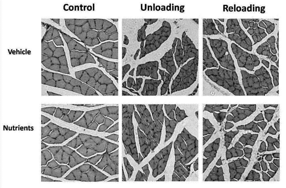 Application of alpha-lipoic acid, acetyl-L-carnitine, coenzyme Q10 and hydroxytyrosol composition for preventing and treating amyotrophy