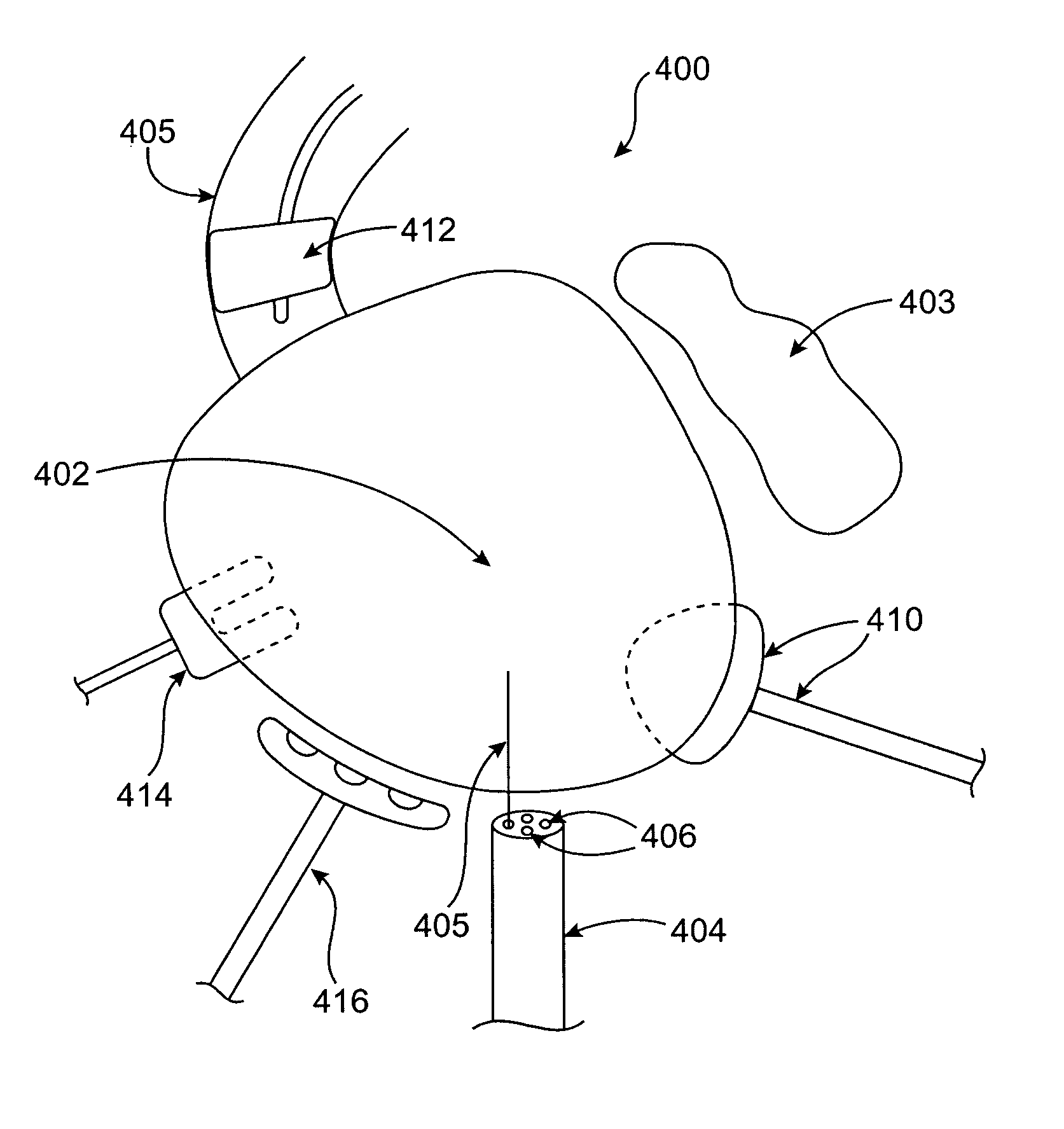 Methods and devices for minimally invasive cardiac surgery for atrial fibrillation