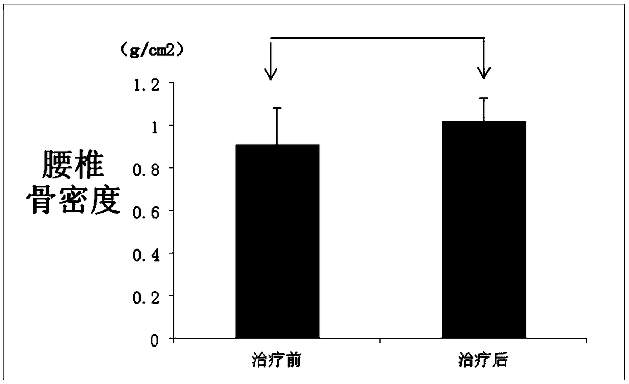 Cell preparation for treating ''female athlete triad'' and repairing ovarian function of female athletes and preparation method thereof