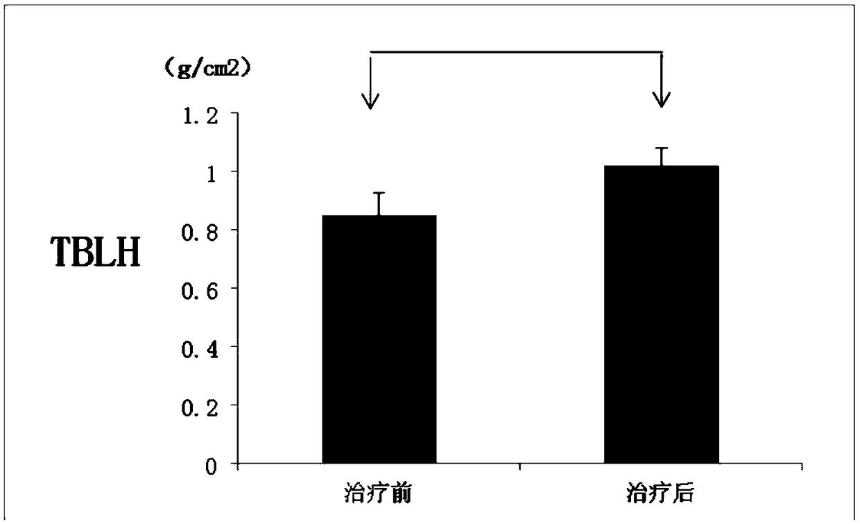 Cell preparation for treating ''female athlete triad'' and repairing ovarian function of female athletes and preparation method thereof