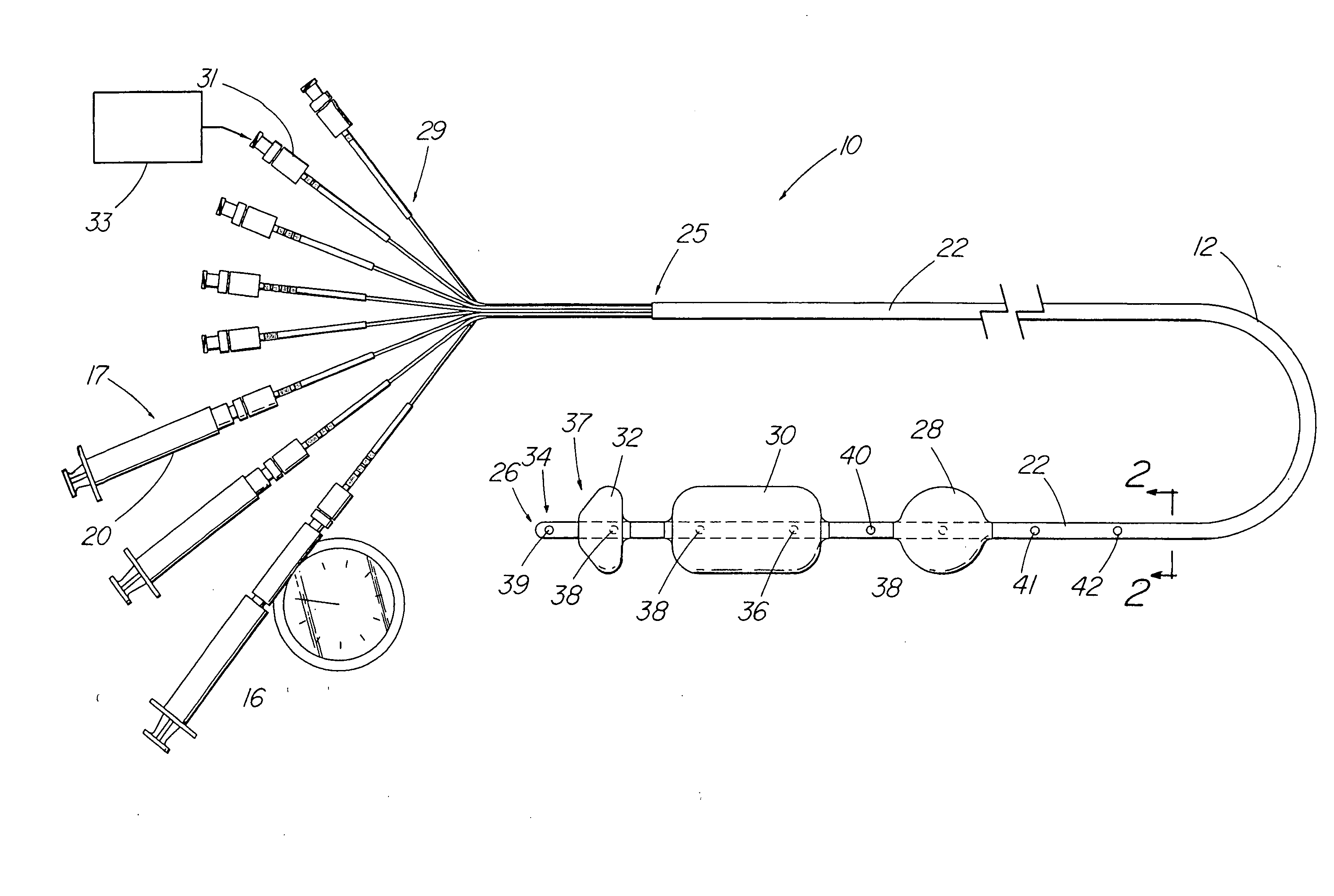 Method for measuring esophageal sphincter compliance