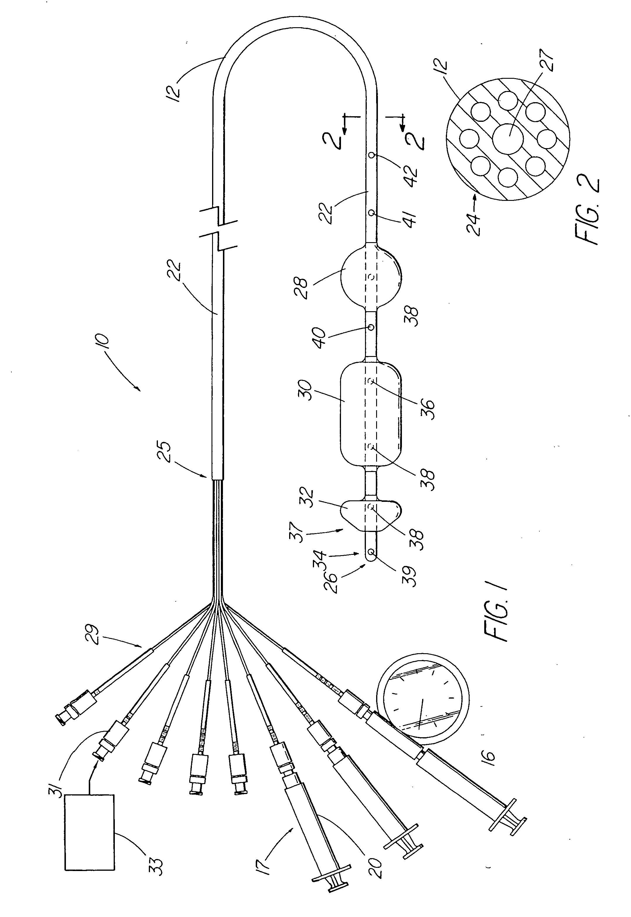 Method for measuring esophageal sphincter compliance