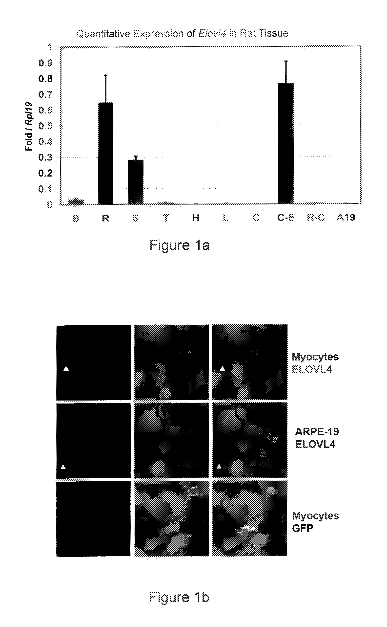 Compositions of very long chain polyunsaturated fatty acids and methods of use