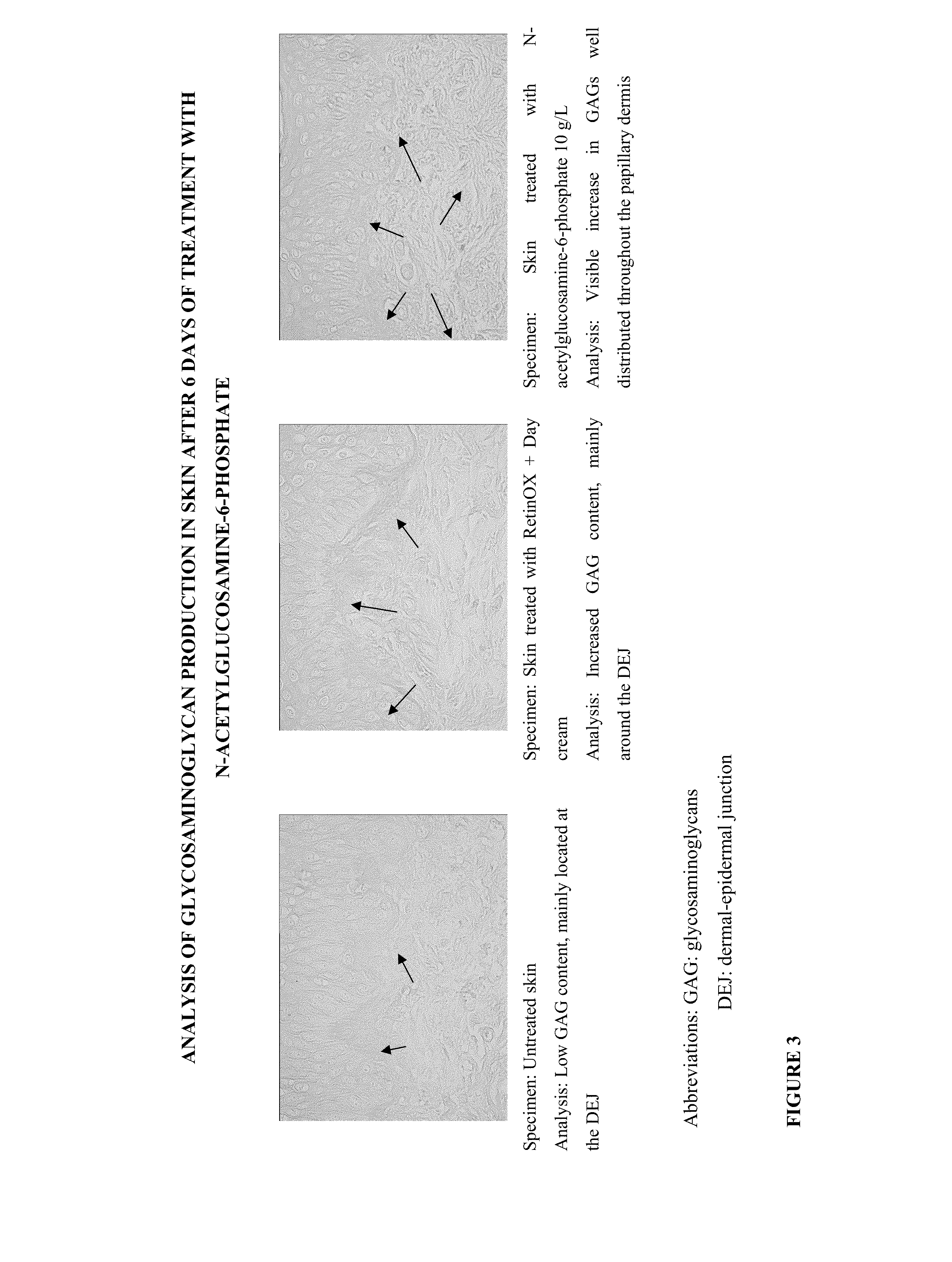 Cosmetic and Pharmaceutical Composition Comprising N-Acetylglucosamine-6-Phosphate