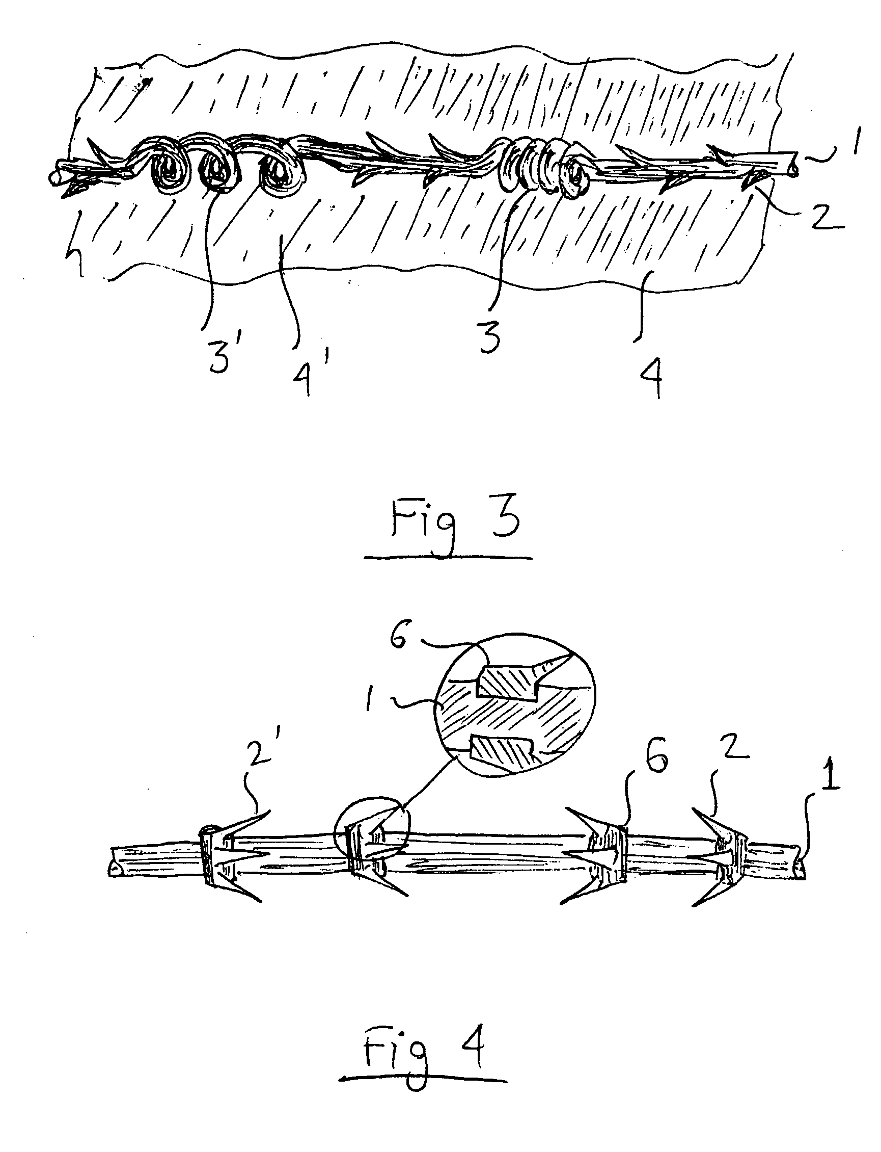Elastic barbed suture and tissue support system