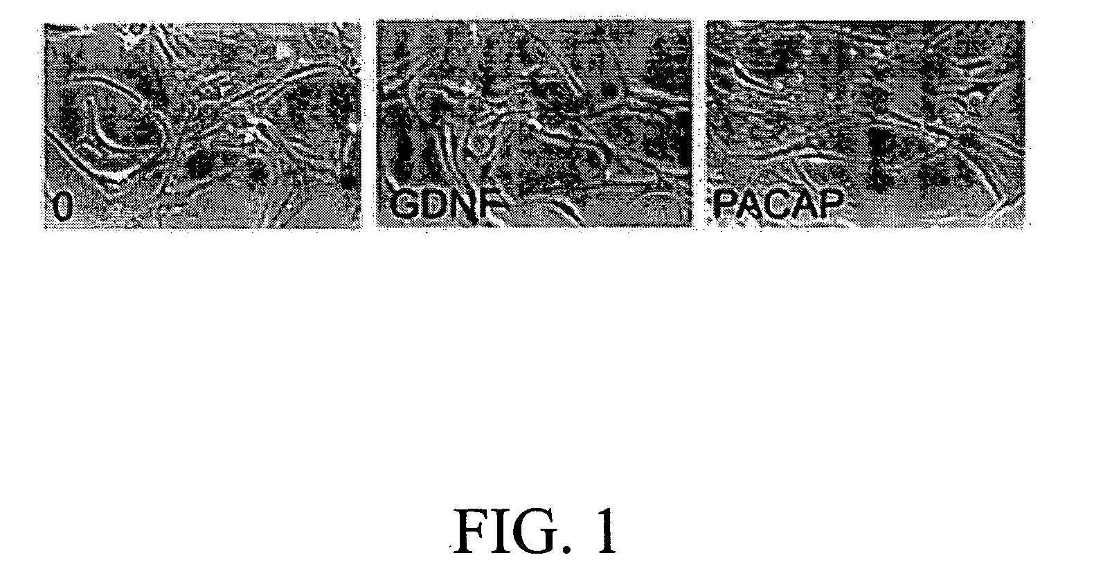 Method for inducing neural differentiation