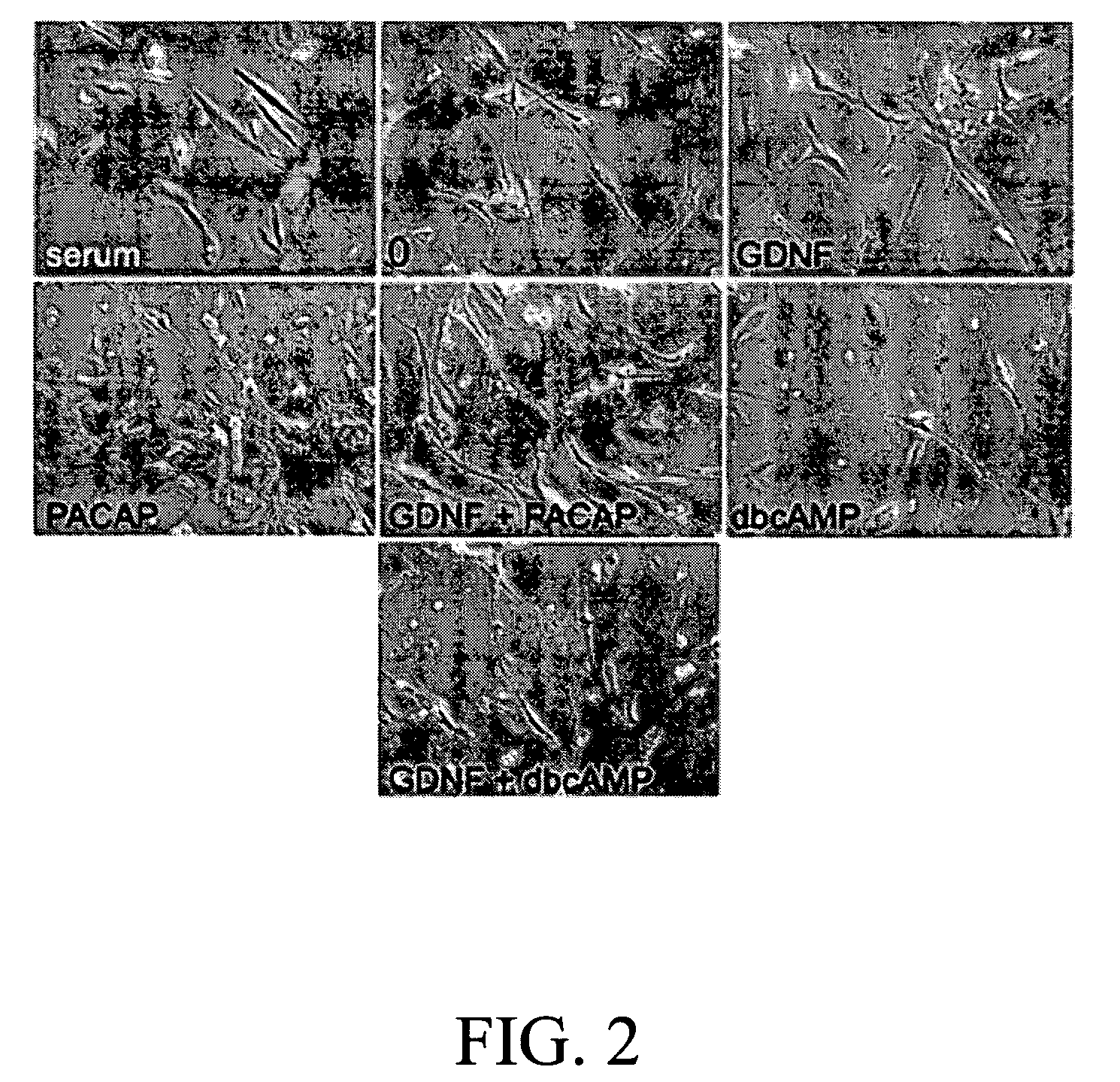 Method for inducing neural differentiation