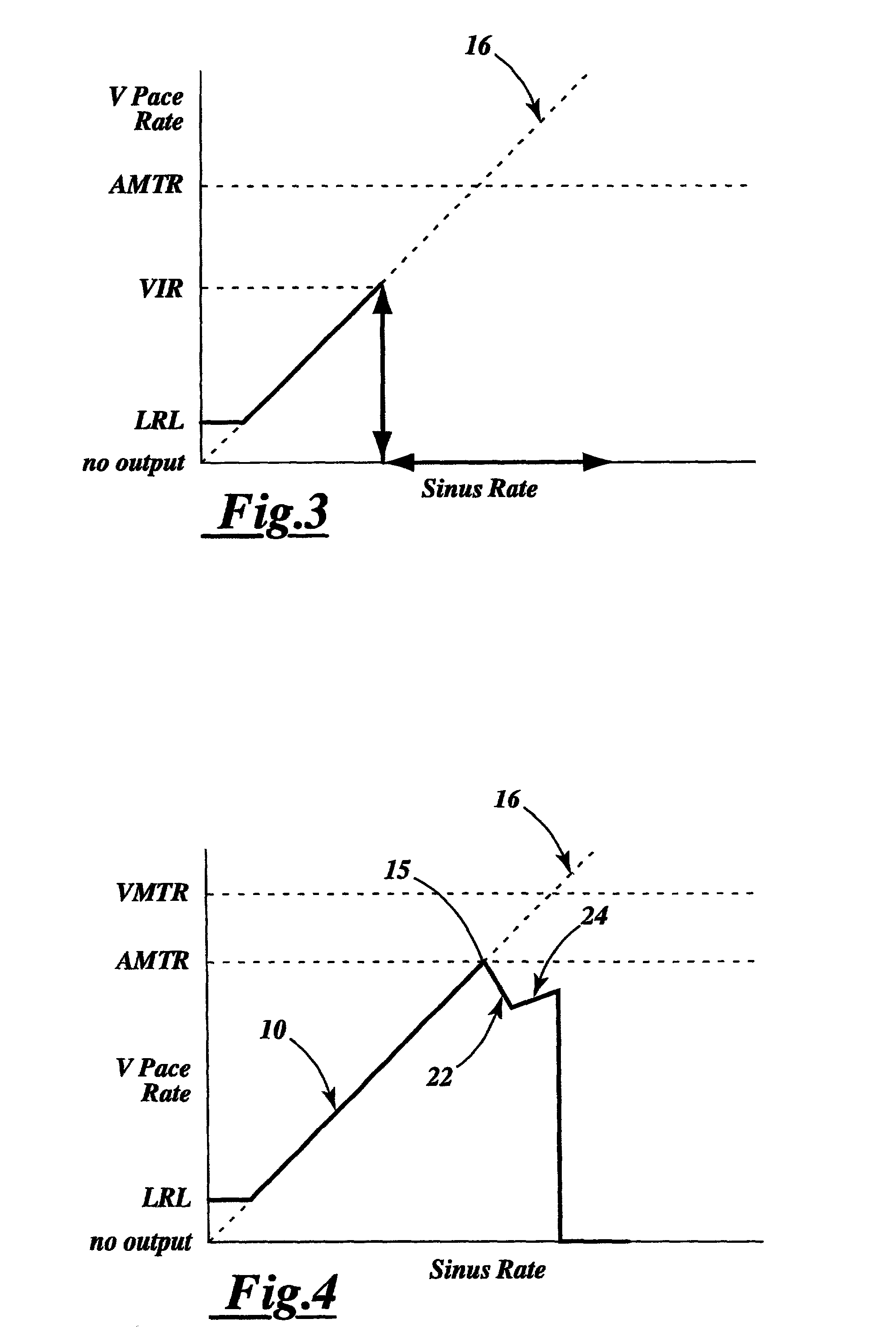 Device and method for ventricular tracking and pacing