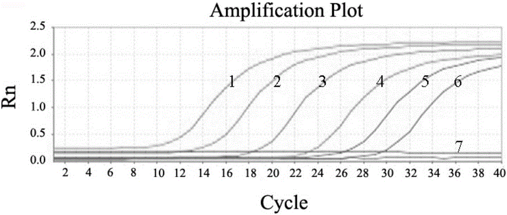 Detection primers of acinetobacter lwoffii and fluorescent quantitative PCR detection method