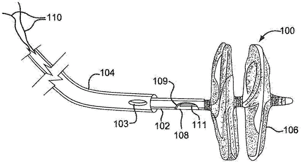 Sealing Device And Delivery System
