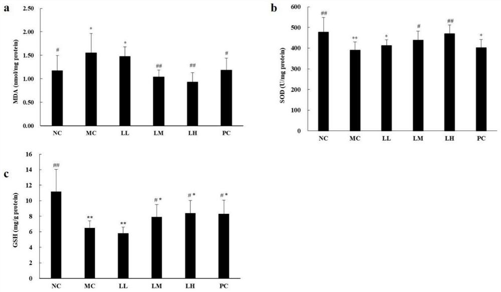 Application of Liquidamia hordgsonii Hook. polysaccharide in preparation of drugs for treating and/or preventing liver diseases