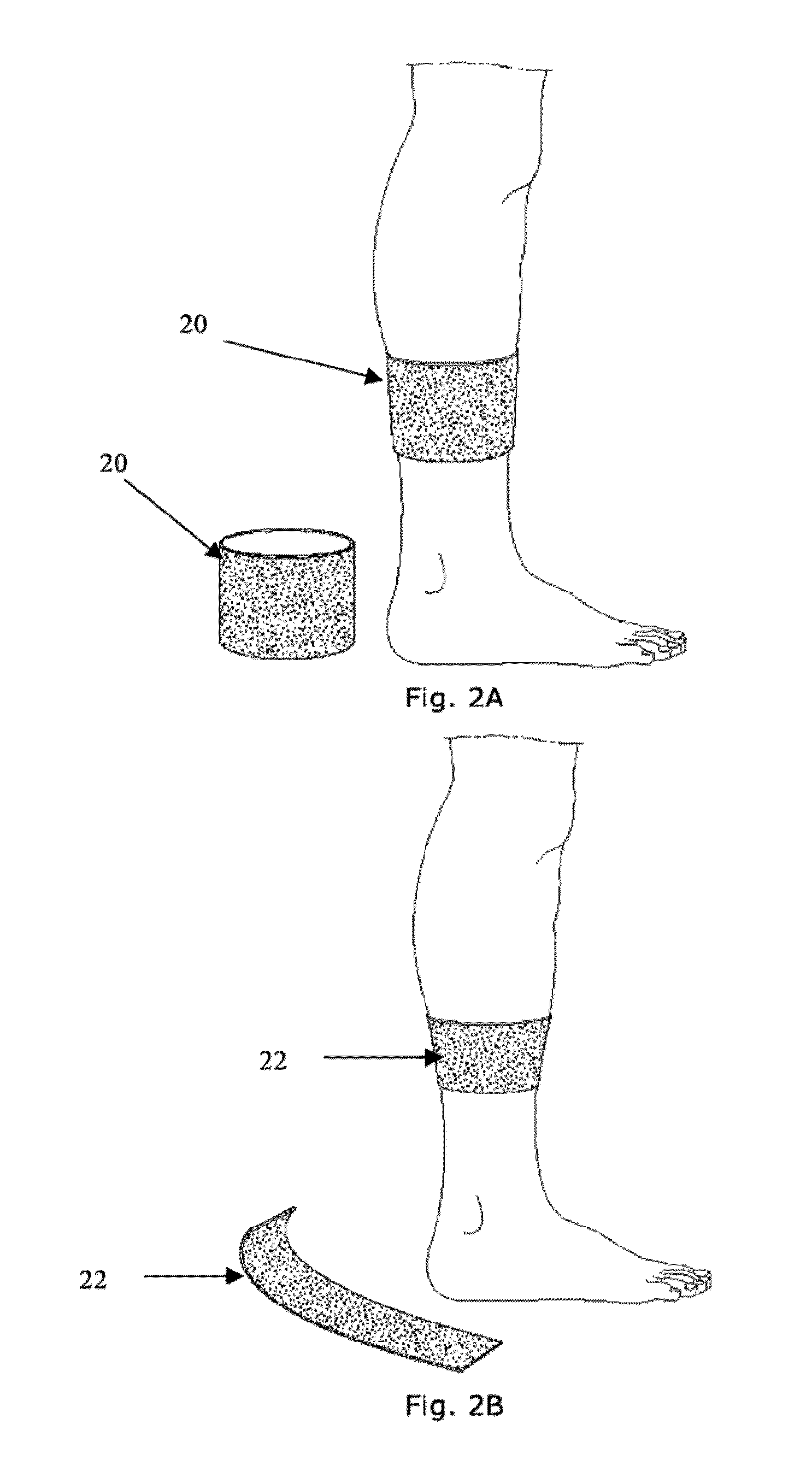 Cosmetic Treatment with Nitric Oxide, Device for Performing Said Treatment and Manufacturing Method Therefor